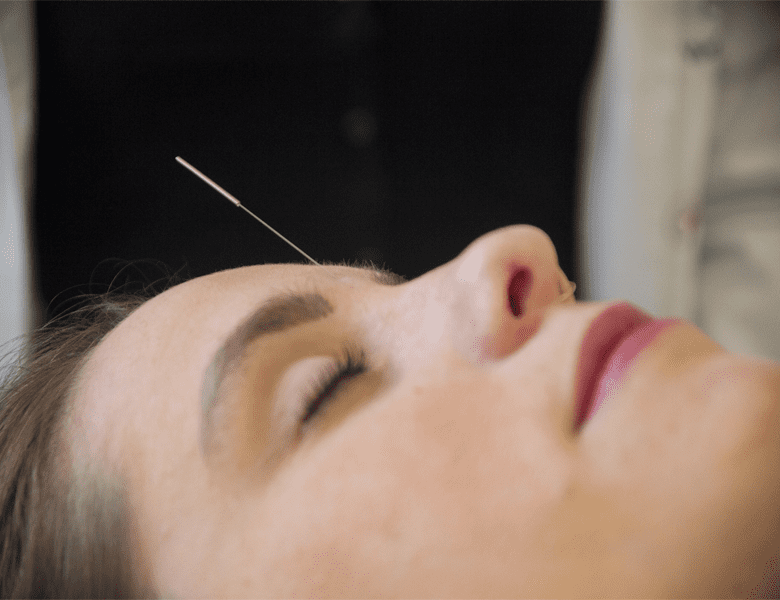 acupuntura-fisiologic